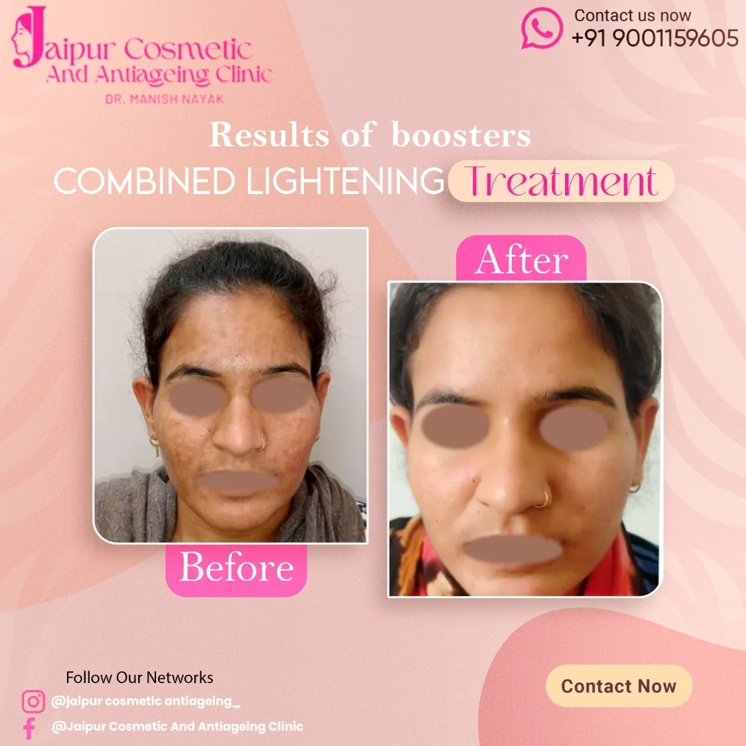 Real Results Boosters when combined with lightening treatments can result in amazing Face trans