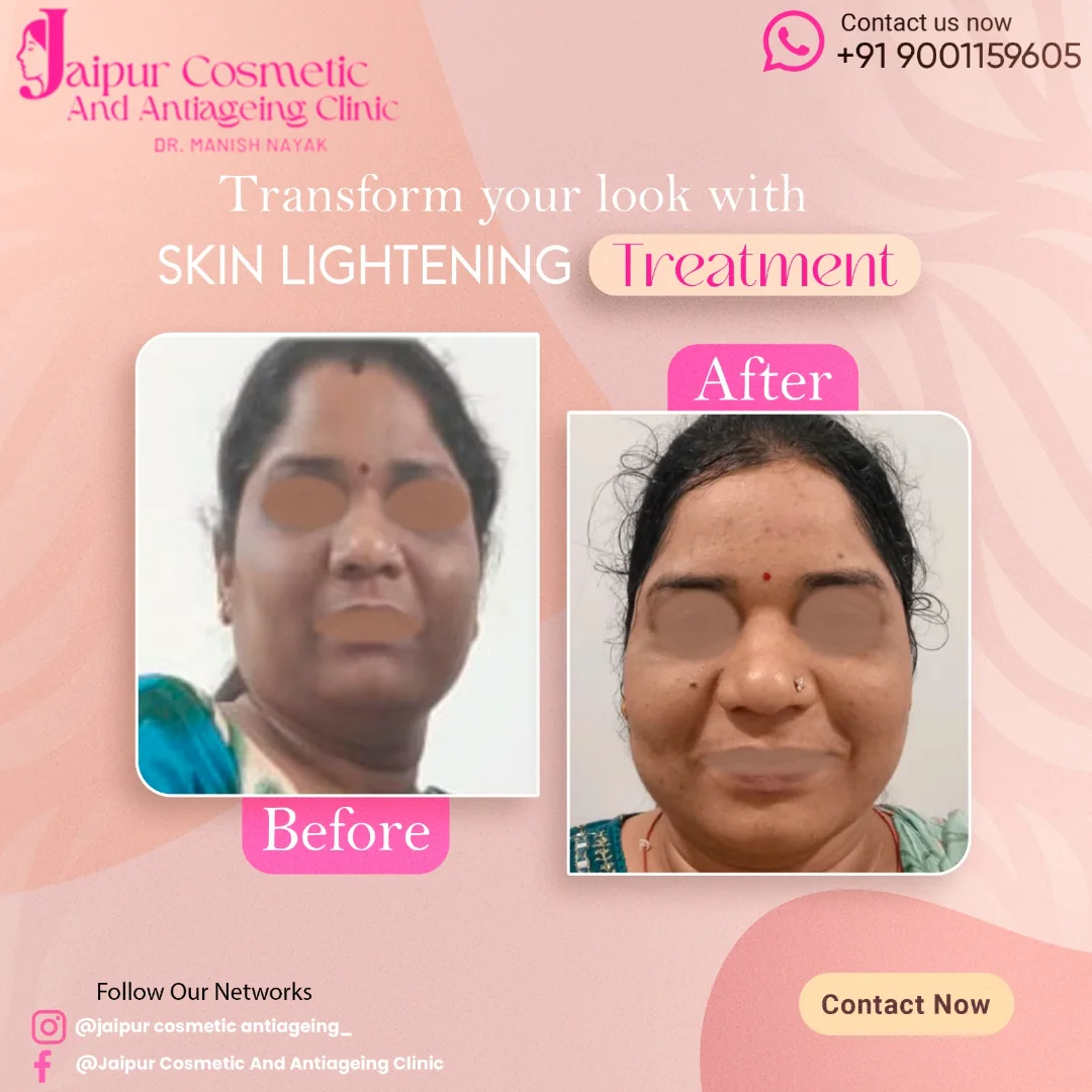 ✨ Real Results - Real Confidence ✨Face care always requires combination of various types of the